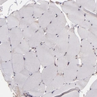 Immunohistochemical staining of human skeletal muscle shows no positivity in myocytes as expected.