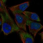 Immunofluorescent staining of human cell line SK-MEL-30 shows localization to nucleoli fibrillar center & cytosol.