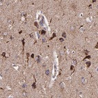 Anti-IDH3G Antibody