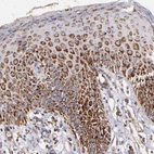 Immunohistochemical staining of human skin shows strong cytoplasmic positivity in epidermal cells.
