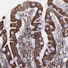 Immunohistochemical staining of human duodenum shows strong granular cytoplasmic positivity in glandular cells.