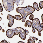 Anti-IDH3G Antibody