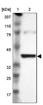 Lane 1: Marker [kDa] 207, 110, 79, 49, 32, 25, 17_br/_Lane 2: Human cell line RT-4