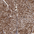 Anti-CD36 Antibody