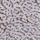 Anti-CD36 Antibody