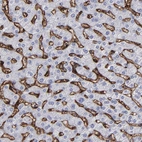 Immunohistochemical staining of human liver shows strong membranous positivity in sinusoids