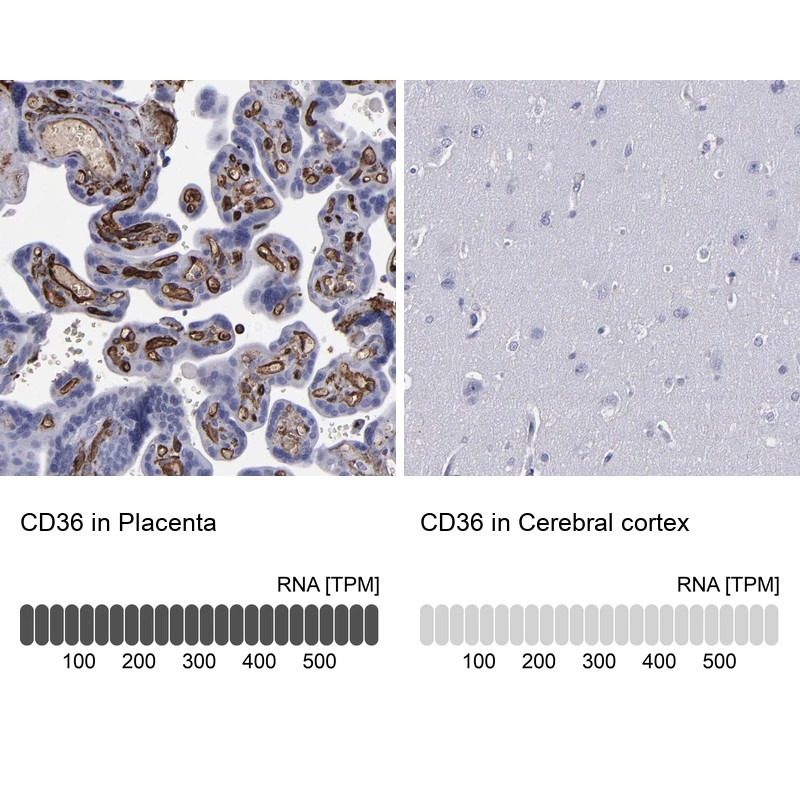 Rabbit Polyclonal Anti-CD36 Antibody - Buy for research - Highly ...