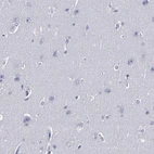 Immunohistochemical staining of human cerebral cortex shows no positivity in neurons as expected.