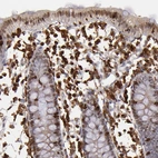 Immunohistochemical staining of human colon shows strong cytoplasmic positivity in lymphoid cells.
