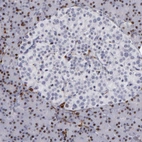 Immunohistochemical staining of human pancreas shows no expression in islets of Langerhans as expected.