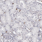 Immunohistochemical staining of human kidney shows no expression in cells in tubules as expected.