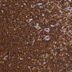 Immunohistochemical staining of human lymph node shows strong cytoplasmic positivity in non-germinal center cells.