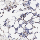 Immunohistochemical staining of human Bone marrow shows strong cytoplasmic and membranous positivity in hematopoietic cells.