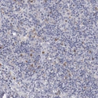 Immunohistochemical staining of human Lymph node shows moderate cytoplasmic and membranous positivity in germinal center and non-germinal center cells.