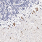 Immunohistochemical staining of human Cerebellum shows moderate cytoplasmic positivity in Purkinje cells.