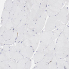 Immunohistochemical staining of human Skeletal muscle shows no positivity in myocytes as expected.