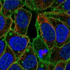 Immunofluorescent staining of human cell line RT4 shows localization to plasma membrane & aggresome.
