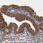 Anti-ERLIN2 Antibody