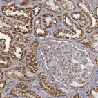 Immunohistochemical staining of human kidney shows strong granular cytoplasmic positivity in cells in tubules.