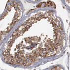 Immunohistochemical staining of human testis shows moderate granular cytoplasmic positivity in cells in seminiferous ducts.