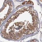 Immunohistochemical staining of human testis shows moderate granular cytoplasmic positivity in cells in seminiferous ducts.