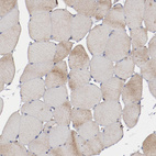 Anti-ERLIN2 Antibody