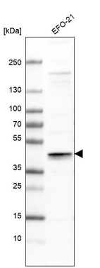 Western blot analysis in human cell line EFO-21.