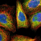 Immunofluorescent staining of human cell line A-431 shows localization to endoplasmic reticulum.