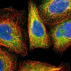 Immunofluorescent staining of human cell line A-431 shows localization to endoplasmic reticulum.