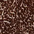 Immunohistochemical staining of human liver shows strong cytoplasmic positivity in hepatocytes.