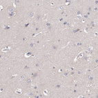 Anti-MBL2 Antibody