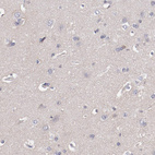 Immunohistochemical staining of human cerebral cortex shows no positivity in neurons as expected.