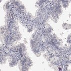 Immunohistochemical staining of human prostate shows no positivity in glandular cells as expected.