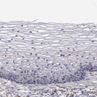 Immunohistochemical staining of human cervix, uterine shows no positivity in squamous epithelial cells as expected