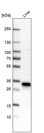 Western blot analysis in human liver tissue.