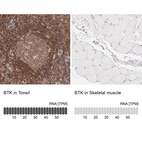 Anti-BTK Antibody