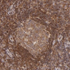 Immunohistochemical staining of human tonsil shows strong membranous positivity in non-germinal center cells.