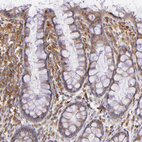 Anti-BTK Antibody