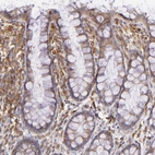 Immunohistochemical staining of human rectum shows moderate membranous positivity in lymphoid cells.