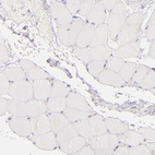 Immunohistochemical staining of human skeletal muscle shows no positivity in myocytes as expected.