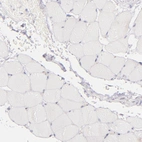 Immunohistochemical staining of human skeletal muscle shows no positivity in myocytes as expected.