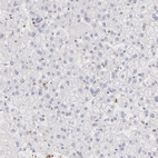 Immunohistochemical staining of human liver shows no positivity in hepatocytes as expected.