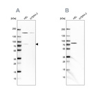 Western blot analysis using Anti-BTK antibody HPA002028 (A) shows similar pattern to independent antibody HPA001198 (B).