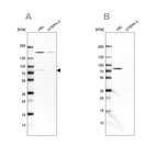 Western blot analysis using Anti-BTK antibody HPA002028 (A) shows similar pattern to independent antibody HPA001198 (B).