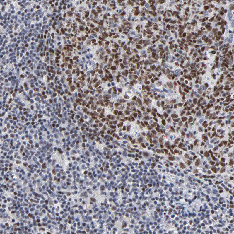 Anti-MBD4 Antibody