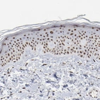 Immunohistochemical staining of human skin shows moderate to strong nuclear speckle positivity in squamous epithelial cells.
