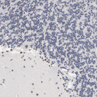 Anti-MBD4 Antibody