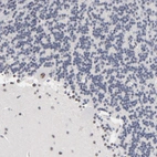 Immunohistochemical staining of human cerebellum shows moderate to strong nuclear speckle positivity in Purkinje cells.