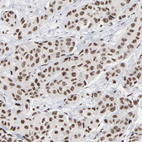 Anti-MBD4 Antibody