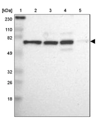 Lane 1: Marker [kDa] 230, 110, 82, 49, 32, 26, 18_br/_Lane 2: Human cell line RT-4_br/_Lane 3: Human cell line U-251MG sp_br/_Lane 4: Human cell line A-431_br/_Lane 5: Human liver tissue